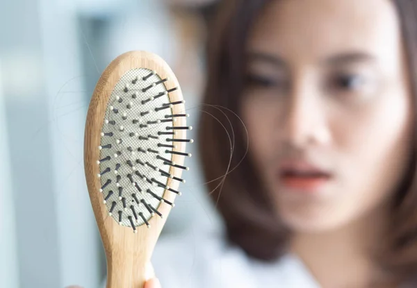 Vrouw hand houden kam met ernstige haaruitval probleem voor bij — Stockfoto