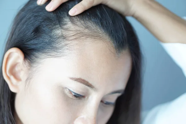 Mulher olhando reflexão no espelho grave problema de perda de cabelo para shampoo cuidados de saúde e conceito de produto de beleza — Fotografia de Stock