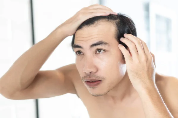 Close up uomo in cerca di riflessione nello specchio grave problema di perdita dei capelli per shampoo sanitario e concetto di prodotto di bellezza — Foto Stock