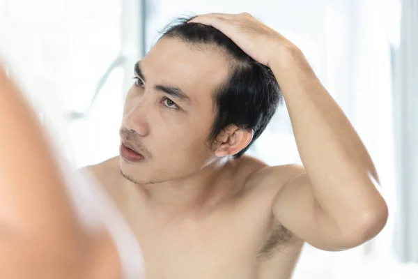 Close up man looking reflection in the mirror serious hair loss problem for health care shampoo and beauty product concept — Stock Photo, Image