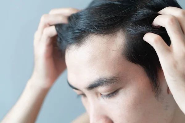 Молодой человек серьезная проблема выпадения волос для здравоохранения медицинской концепции и шампуня продукт, избирательный фокус — стоковое фото