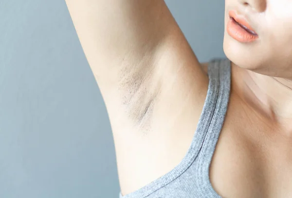 Kvinnor problem svart armhåla med grå bakgrund för hudvård och skönhet koncept, selektivt fokus — Stockfoto