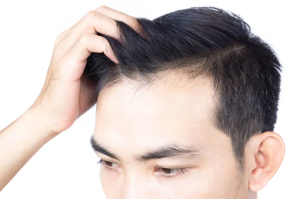 Молодий чоловік серйозна проблема випадіння волосся для медичної допомоги та концепції шампуню, селективний фокус — стокове фото
