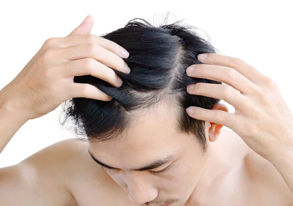 Молодий Чоловік Серйозна Проблема Випадіння Волосся Охорони Здоров Медичної Шампунь — стокове фото