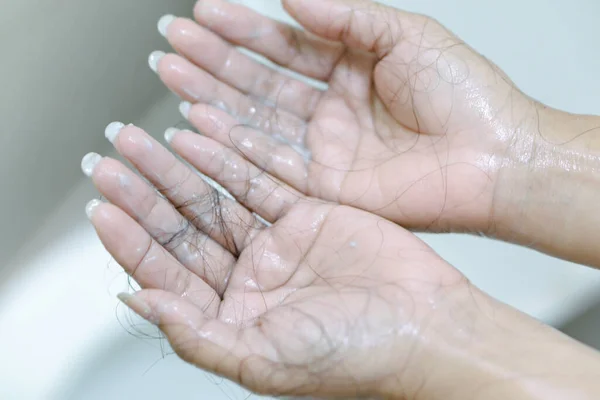 Closeup Hair Loss Woman Hand Bathroom — Stock Photo, Image