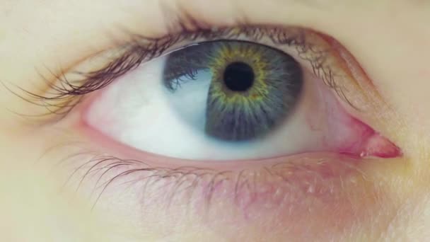 Голубые Глаза Молодой Женщины Оглядывающейся Ослепляющейся Процесс Сужения Зрачков Ослепляющие — стоковое видео