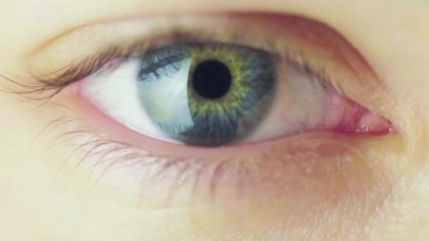 Makro View Pupil Constriction Process Human Eye Förträngning Iris Med — Stockvideo
