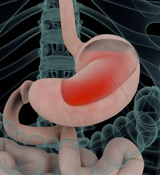 Anatomía Ilustración Ácido Gástrico Acidez Estomacal Inflamación Del Estómago Rojo — Foto de Stock