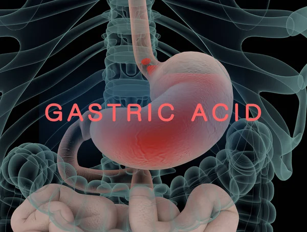 Anatomy illustration of gastric acid or heartburn, inflamed red stomach showing acid in red. 3D illustration.