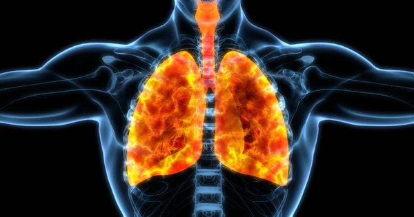 Human Lungs Medical Illustration Showing Infected Lungs Bright Orange Illustration — Stock Photo, Image