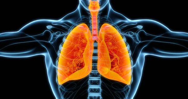 人类肺部医学图解显示 感染的肺呈明亮橙色 3D插图 图库图片