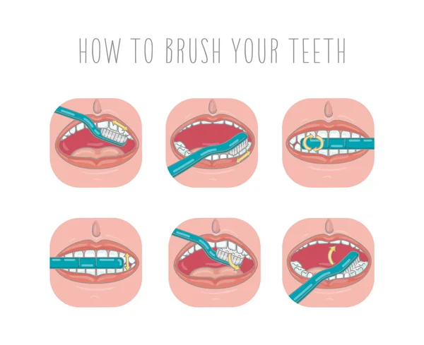 Cómo Cepillarse Los Dientes Plantilla Infografía Vectorial Ilustración Plana — Archivo Imágenes Vectoriales