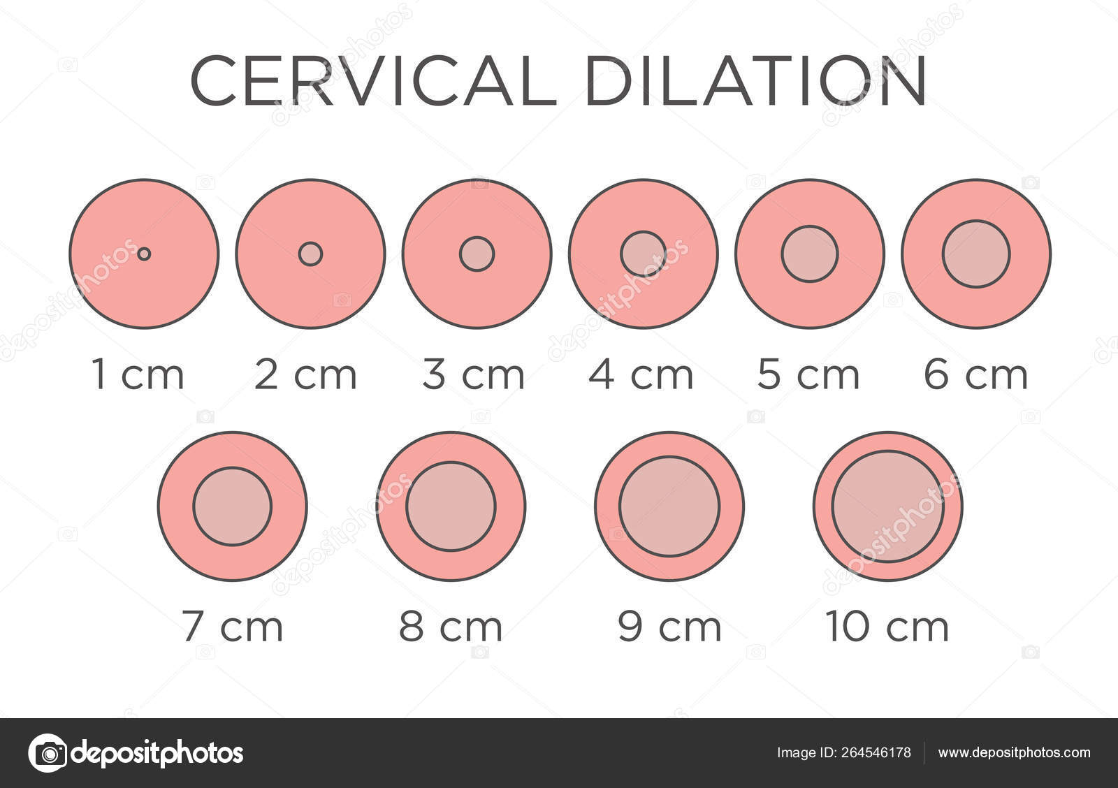 Cervial Dilation Medical Illustration Chart In Centim - vrogue.co