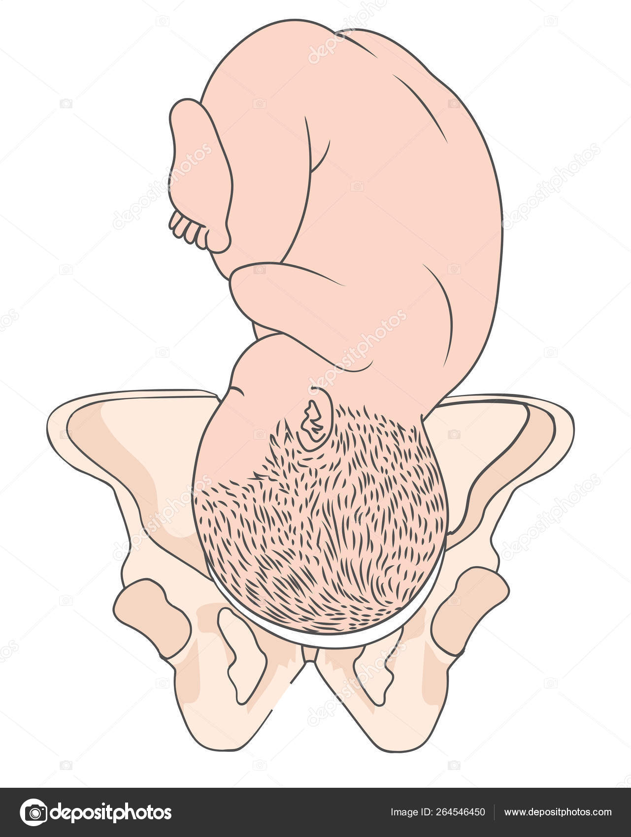 Roa baby position | Left Occiput Anterior LOA Baby Fetal Position ... Roa baby position | Left Occiput Anterior LOA Baby Fetal Position ...
