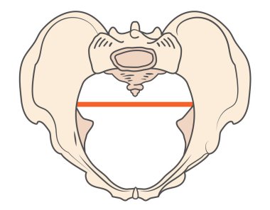 Yuvarlak Anthrepoid Pelvis Şekli - Oval şekil