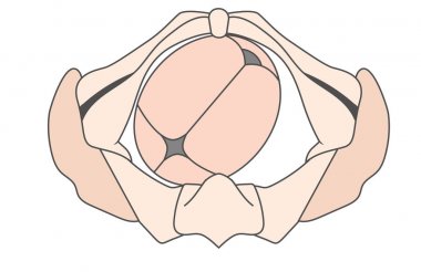 Sol Occiput Anterior Loa Bebek Fetal Pozisyon Pelvis - Roa Sağ