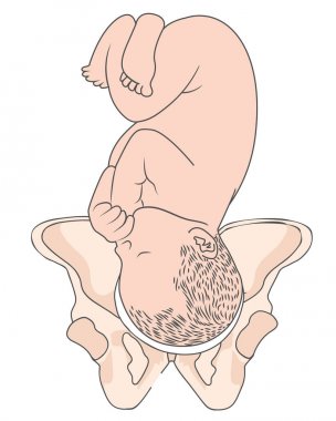 Sol Oksiput Enine Lot Bebek Fetal Pozisyon Pelvis Çürüksağ