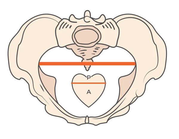 Androide Beckenform mit dreieckiger / herziger Form — Stockvektor