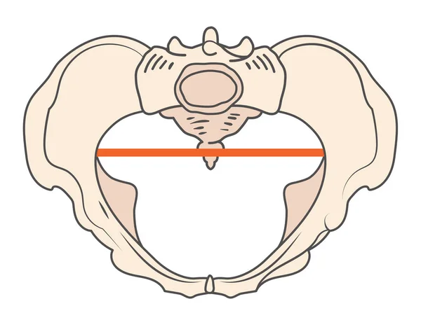 Forma de la pelvis de Android w Triangular / Forma del corazón — Vector de stock