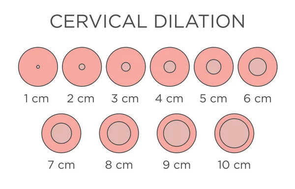 Cervial Dilation Medical Illustration - chart in centimeters — Stock Vector