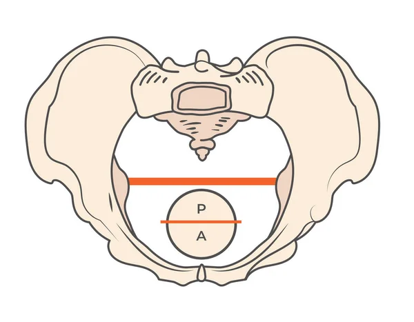 Forma de la pelvis ginecoide con forma redonda / circular — Archivo Imágenes Vectoriales