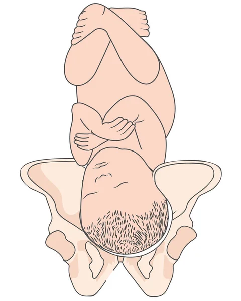 Occiput gauche LOP postérieur Bébé Position foetale Bassin ROP droite — Image vectorielle
