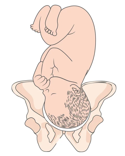 Occipucio izquierdo Lote transversal Posición fetal del bebé Pelvis ROT Derecha — Vector de stock