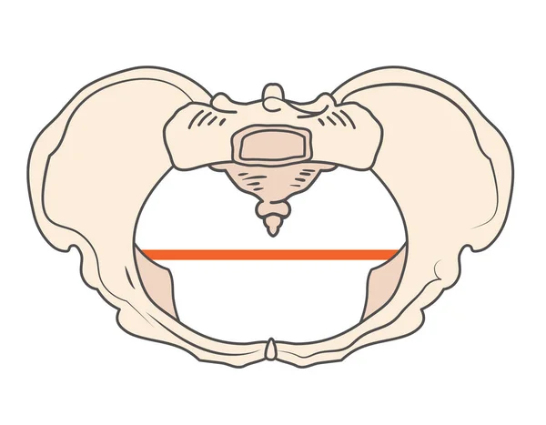 Platypoid o Platypelloid Pelvis Shape w forma redonda o circular — Vector de stock