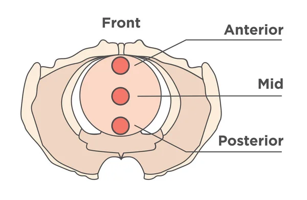 Pelvis medical illustration showing front, anterior, mid, & post — Stock Vector