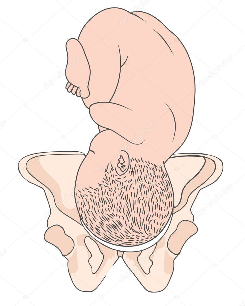 Left Occiput Anterior LOA Baby Fetal Position  ROA Right