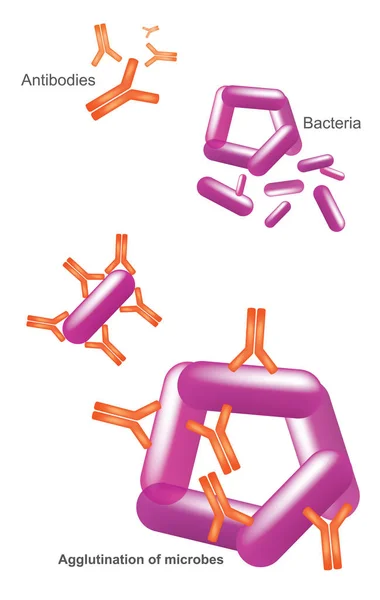 Anticuerpos Bacterias Ilustración Salud Infografía Médica — Vector de stock