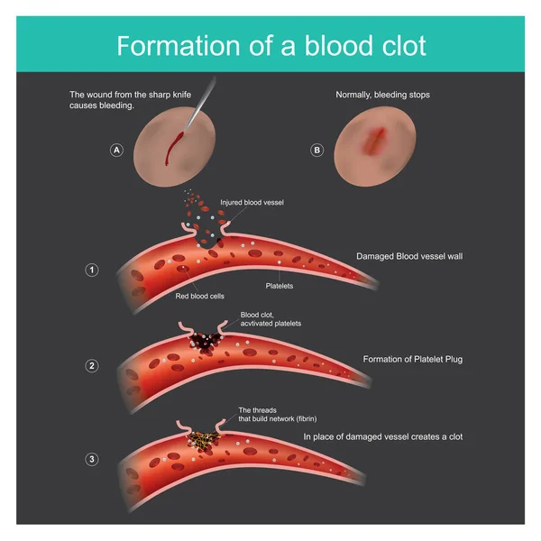 Blessure Couteau Tranchant Sur Peau Saignement Léger Corps Peut Réagir — Image vectorielle