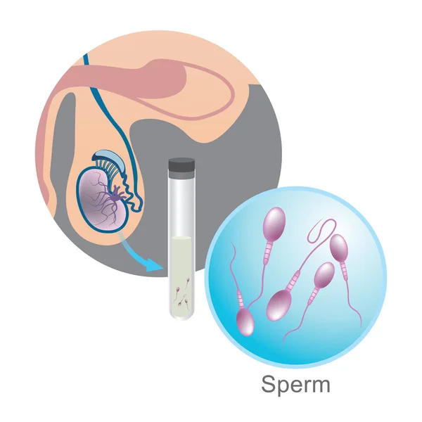 Vitro Fertilization Sperm Illustration Infographie Éducative — Image vectorielle