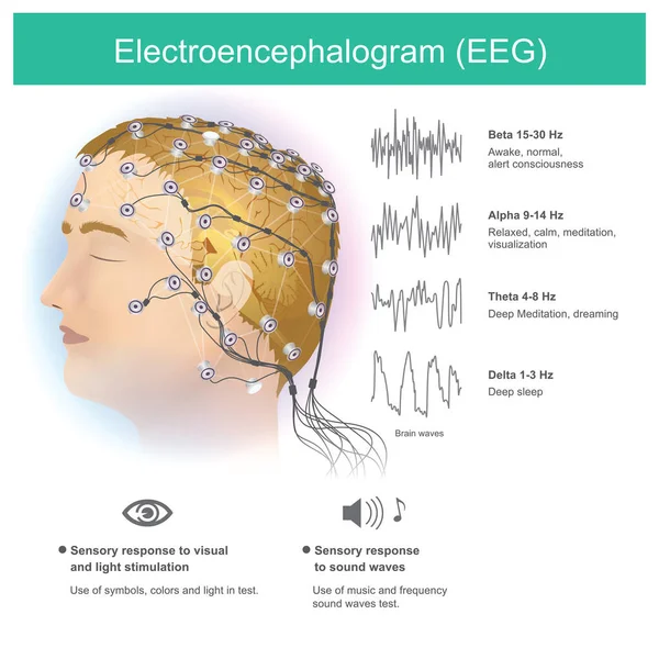 Penggunaan Elektroda Untuk Membaca Gelombang Elektromagnetik Kecil Dari Otak Manusia - Stok Vektor