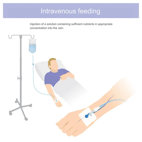 Inyección Solución Que Contenga Suficiente Nutriente Concentración Adecuada Vena Gráfico — Vector de stock