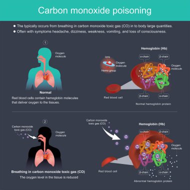 Carbon monoxide poisoning.  The typically occurs from breathing in carbon monoxide toxic gas (CO) in to body large quantities. Often with symptoms headache, dizziness, weakness, vomiting, and loss of consciousness. clipart