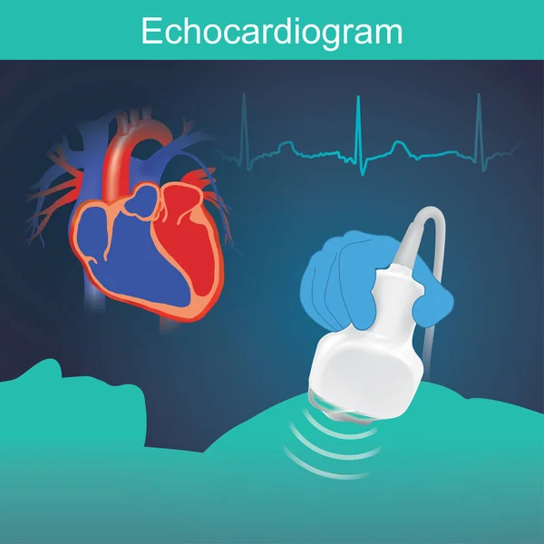 Examen Cardíaco Con Ondas Sonoras Alta Frecuencia Muy Útil Evaluación — Vector de stock