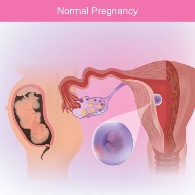 Bir yumurta fallop tüpü ve rahim duvarı içine normal ders.
