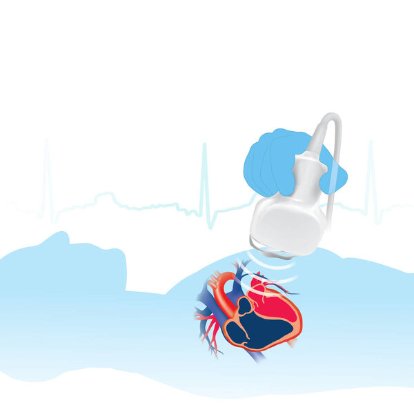 Эхокардиограмма белый фон. Информация graphic.Heart обследование с высокой частотой звуковых волн Очень полезно для оценки функции сердца, в том числе других симптомов
.