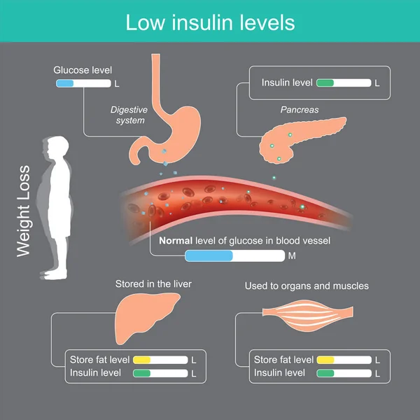Lage insulineniveaus. — Stockvector
