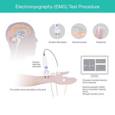 Electromyography Test Procedure. clipart