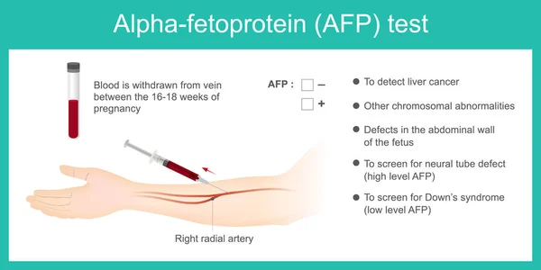 Εμβρυϊκή πρωτεΐνη Alpha δοκιμή AFP. — Διανυσματικό Αρχείο