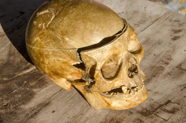 Cráneo Humano Mayor Mujer Parte Cuerpo Muerte Halloween — Foto de Stock