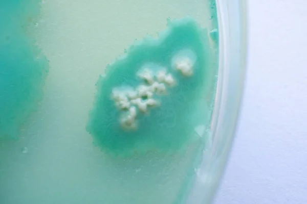 Een Macro Schimmel Cultuur Petrischaal Plate Top Uitzicht Mycelium Van — Stockfoto