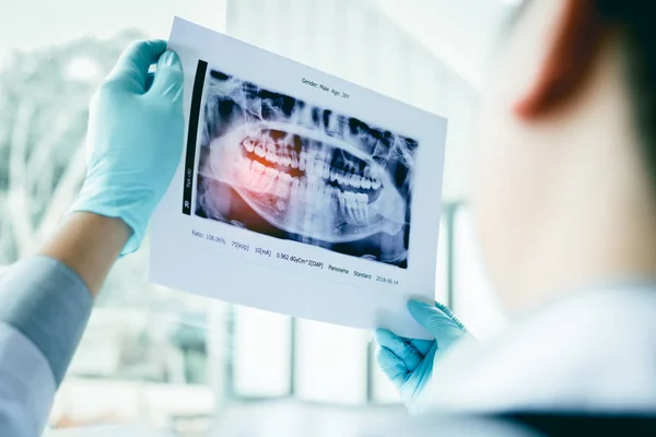 Los Dentistas Masculinos Asiáticos Están Analizando Imágenes Rayos Pacientes Laboratorio — Foto de Stock