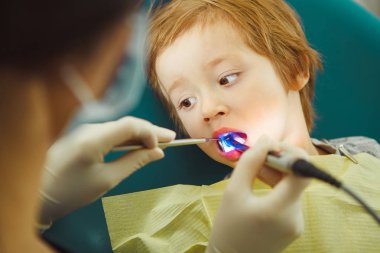 Ultraviyole dolgular çocuk uygulanması. Hasta çocuk diş hekimi.