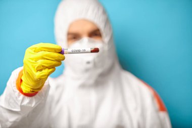 Coronavirüs için ekspres test. Korumacı bilim adamları kan testi yaptırıyor..