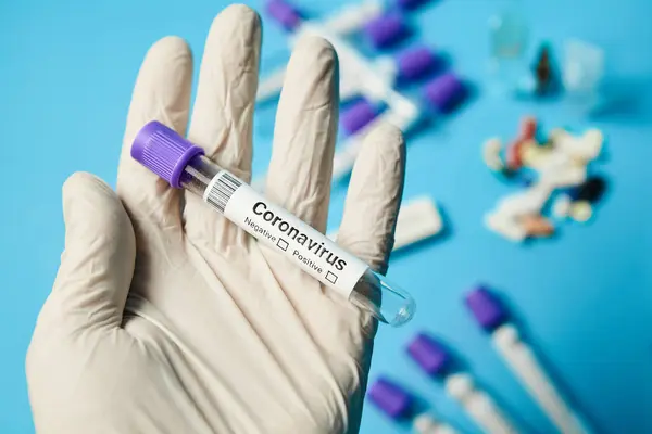 Amostra de tubos médicos para análise de coronavírus, pesquisa de laboratório para criar a vacina contra um novo vírus covid-19. — Fotografia de Stock