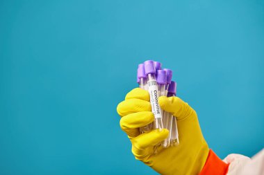 Koruyucu eldivenli tıbbi çalışanın yakından görüntüsü koronavirüs için test tüpleri içeriyor. Salgın virüsü solunum sendromu. Çin, Wuhan.