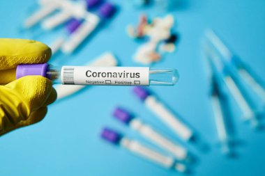 Corona virüsünün örnek analizi için tıbbi tüp, yakın plan..